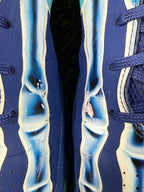 Kobe 5 “X-Ray” (Size 15)